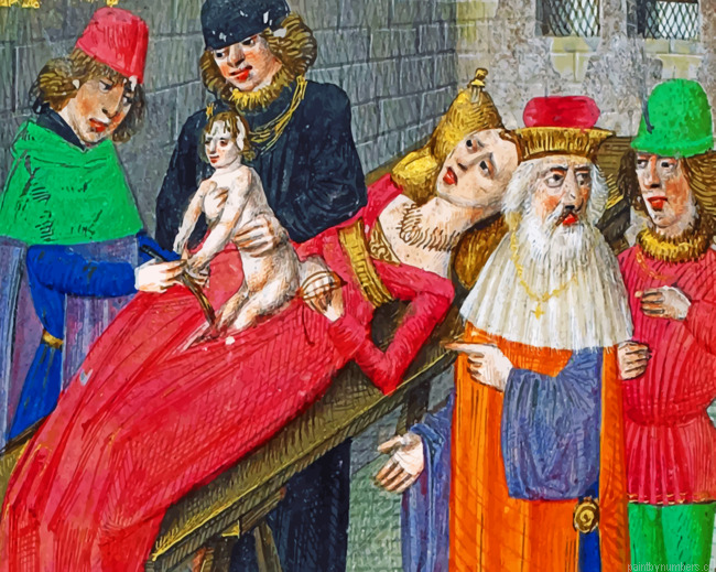 Medieval Surgeons Painting By Numberss.png