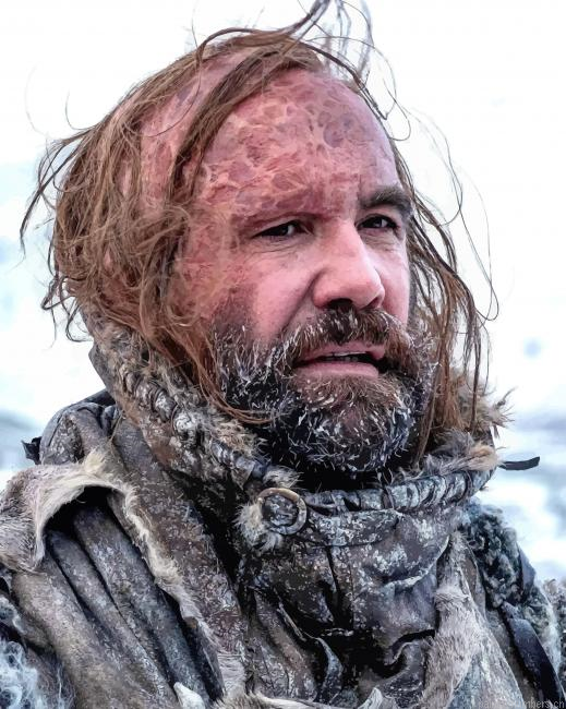 The Hound Sandor Clegane Got Painting By Numbers.png